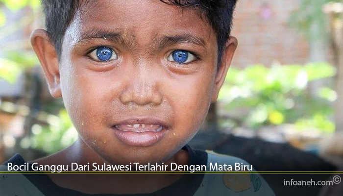Bocil Ganggu Dari Sulawesi Terlahir Dengan Mata Biru